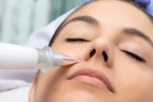 Best Actinic Keratoses Removal 3 Actinic keratoses Smethwick solutions - book in today!